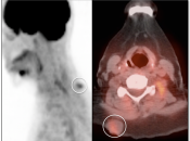 Case 2 (Image 1)