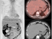 Case 4 (Image 1)
