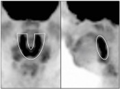 Case 1 (Image 1)