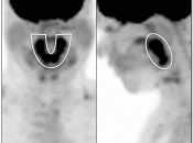 Case 2 (Image 1)