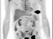 Case 2 (Image 1)