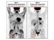 Figure 4 (Image 2) poor patient prep