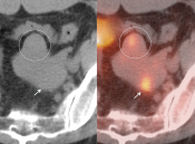 Case 1 (Image 2)