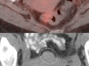 Case 2 (Image 2)