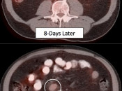Figure 5 (Image 2) poor patient prep