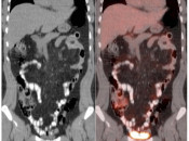Case 1 (Image 2)