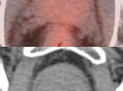 Case 1 (Image 2)
