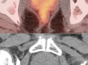 Case 4 (Image 2)