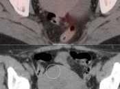 Case 3 (Image 2)