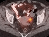 Case 1 (Image 2)