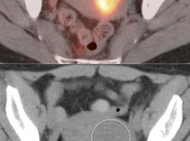 Case 4 (Image 2)