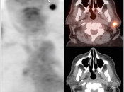 Case 1 (Image 2)