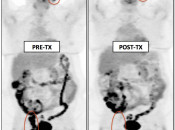 Case 4 (Image 2)
