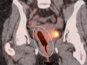 Case 1 (Image 2)