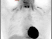 Case 6 (Image 2)