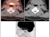 Case 1 (Image 2)