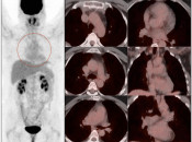 Case 1 (Image 2)