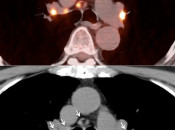 Case 3 (Image 2)
