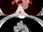 Case 4 (Image 2)