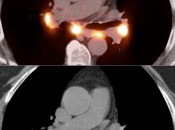 Case 5 (Image 2)