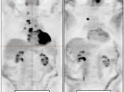 Case 6 (Image 2)