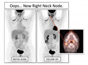 Figure 5 (Image 2) brown fat case 5