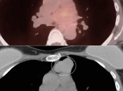 Case 4 (Image 2)