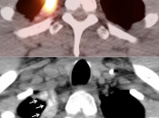 Case 1 (Image 2)
