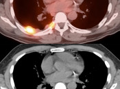 Case 3 (Image 2)
