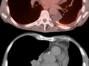Case 4 (Image 2)