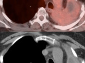 Case 6 (Image 2)