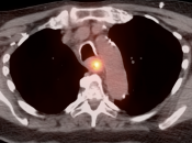 Case 4 (Image 2)