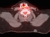 Case 1 (Image 2)