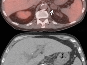 Case 2 (Image 2)