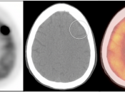 Case 7 (Image 2)
