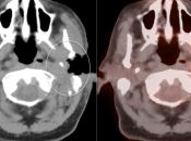 Case 11 (Image 2)