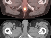 Case 1 (Image 2)