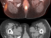 Case 2 (Image 2)