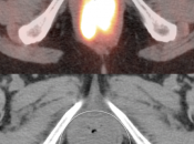 Case 3 (Image 2)