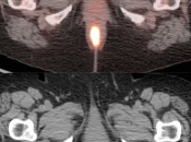 Case 4 (Image 2)