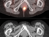 Case 5 (Image 2)