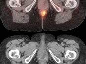 Case 6 (Image 2)