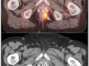 Case 7 (Image 2)