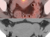 Case 2 (Image 2)