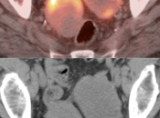 Case 4 (Image 2)