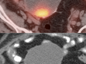 Case 6 (Image 2)