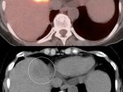 Case 7 (Image 2)