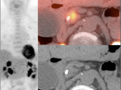 Case 1 (Image 2)