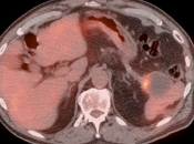 Case 6 (Image 2)