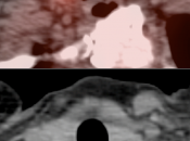 Case 2 (Image 2)